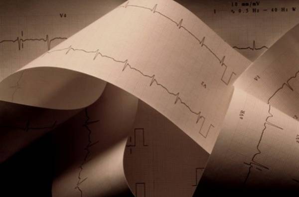 Электрофизиология сердца. Регистрация и расшифровка ЭКГ