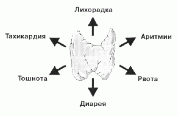 Тиреотоксический криз и тиреотоксическая кома