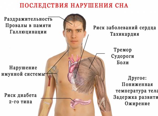 Нарушение сна и сердечно-сосудистые заболевания 