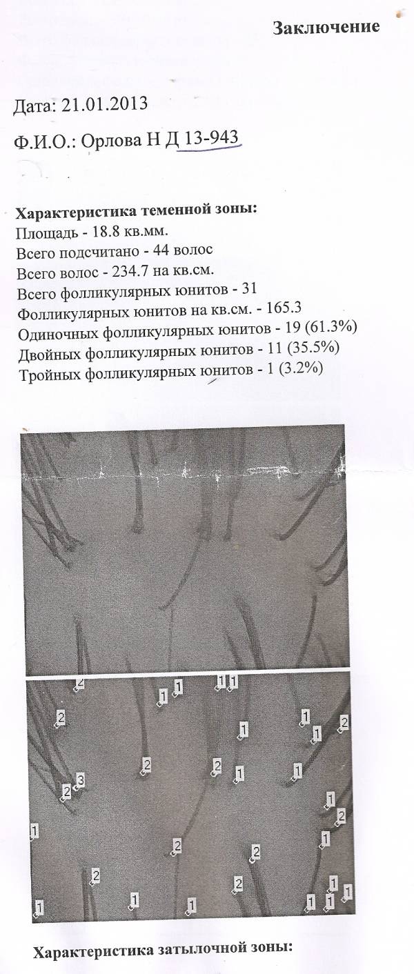 Потеряли 70% волос после окраски. Пожалуйста, помогите! (результаты анализов прилагаются)