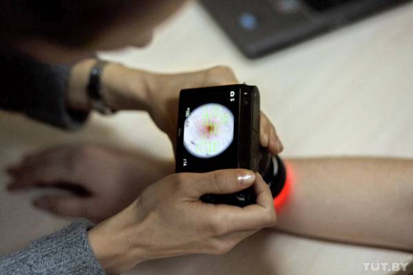 Белорусские ученые создали систему, которая диагностирует меланому по фотографии
