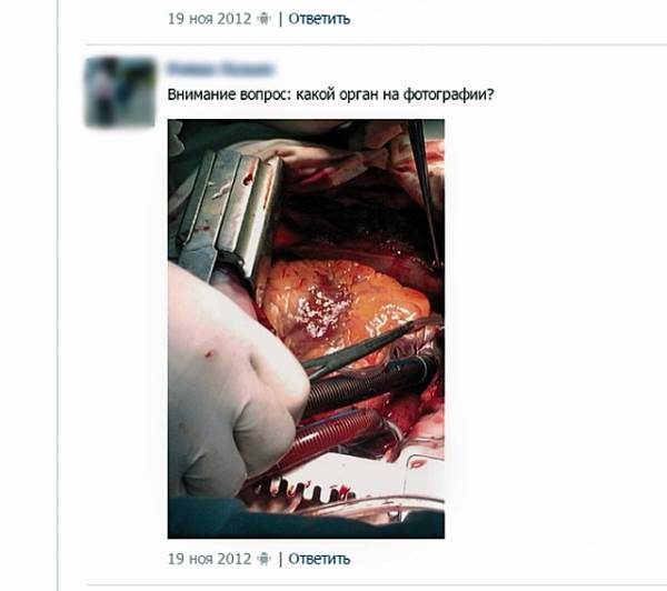 Скандал в Гомеле. Журналист раскопал аккаунт врача-хирурга гомельской больницы, который выкладывал в интернет фото внутренних органов пациентов