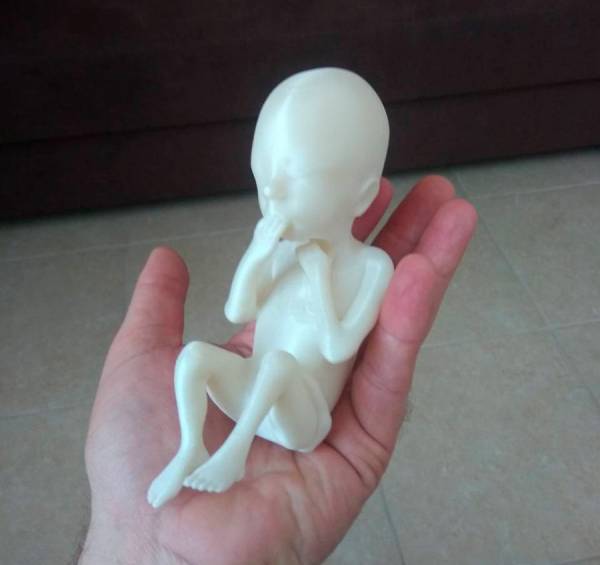 В Беларуси появилась новая услуга: 3D-печать модели будущего ребенка