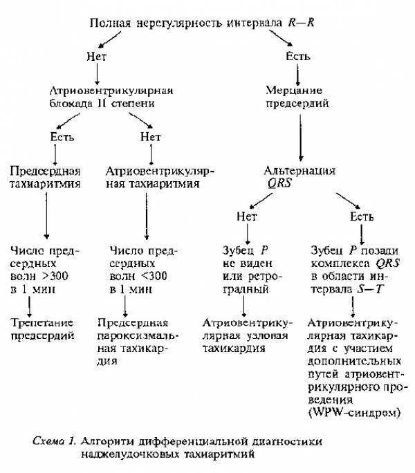 Дифференциальная диагностика наджелудочковых аритмий