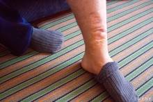 После ДТП и операций у Сергея на ноге остался шрам 