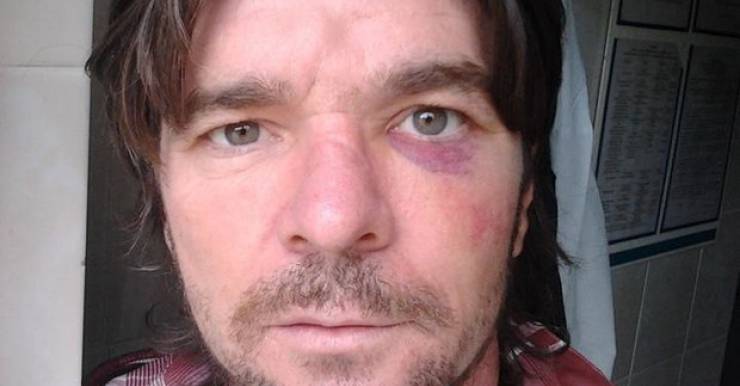 Скандал в «Городской туберкулезной больнице» в Волковичах: пациент пожаловался в прокуратуру по факту избиения 