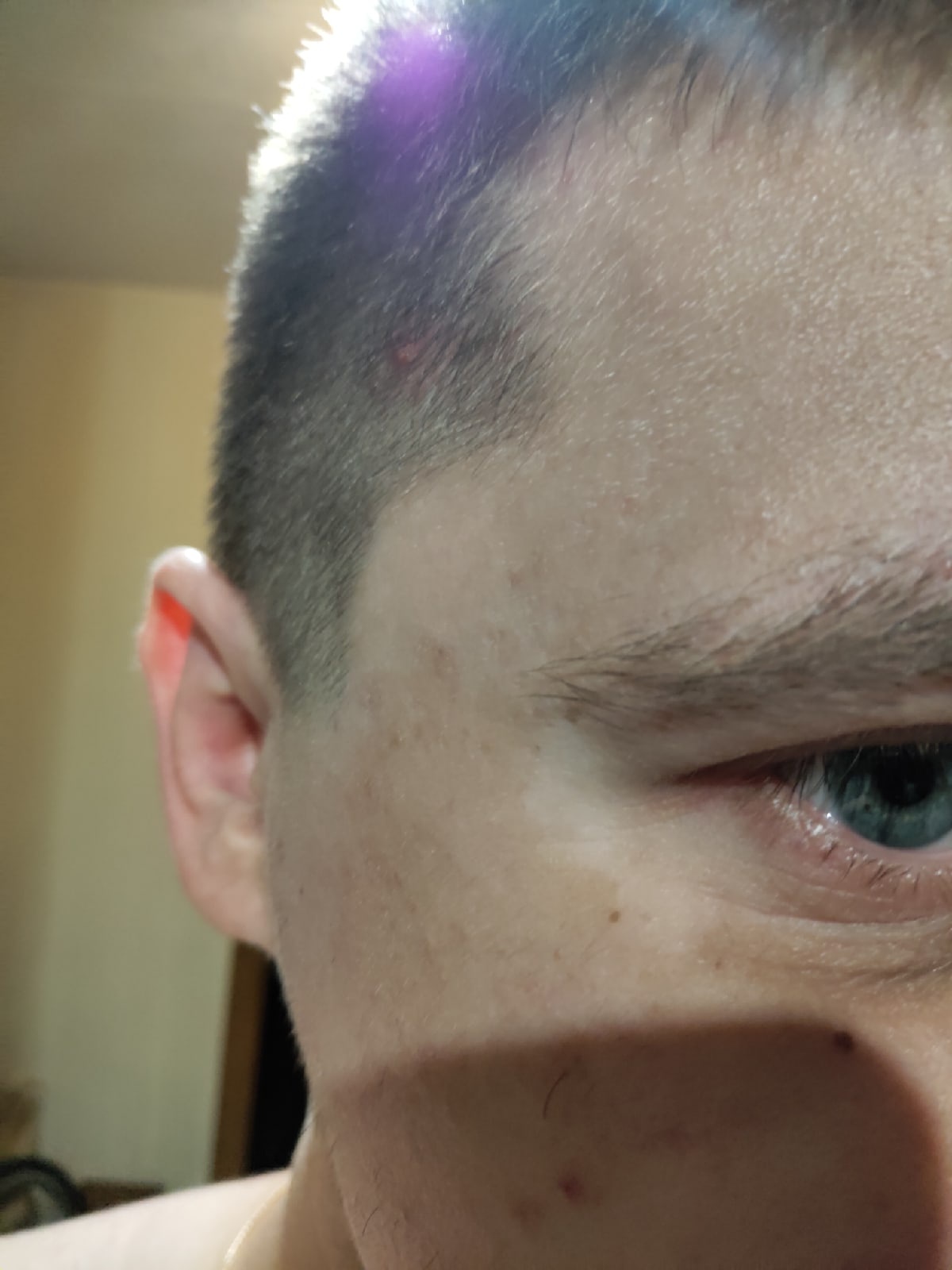 Подскажите пожалуйста, что это у меня за белые пятна на лице и на руках? | Консультация дерматолога в Минске на DOKTORA.BY - ВРАЧИ БЕЛАРУСИ